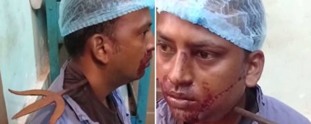 مرد هندی که یک نیزه سه شاخ در گردنش فرو رفته بود به طور معجزه‌آسایی زنده ماند + ویدیو