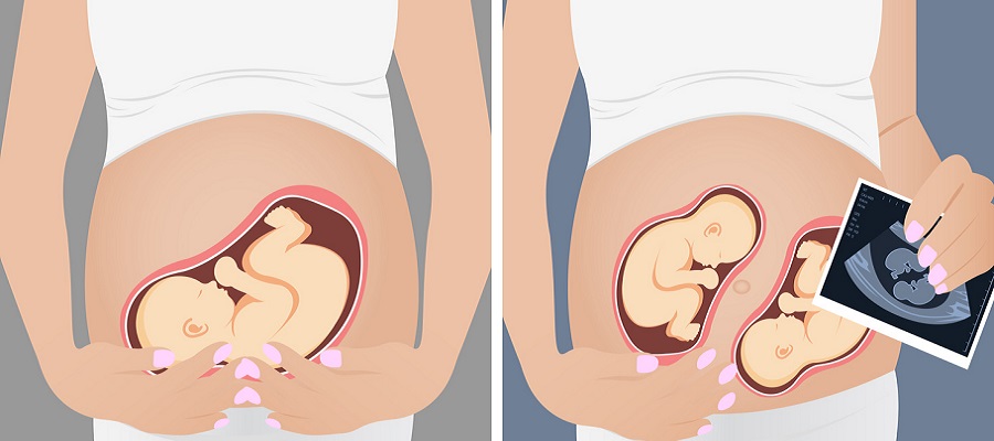 چرا بعضی زن ها حین بارداری دوباره باردار می شوند؟