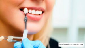 3 دلیل برای استفاده از روکش برای دندانهای پوسیده