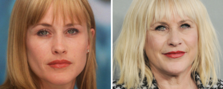 پاتریشیا آرکت ۵۴ ساله فاش کرد که به فکر لیفت صورت است و بیشتر زنان دلیلش را می‌دانند