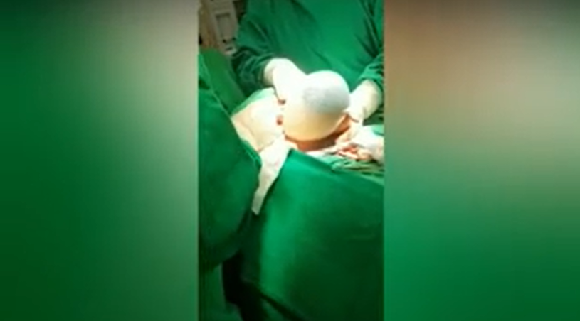 اتفاق نادر تولد یک نوزاد با کیسه آب سالم!