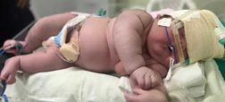 نوزادی ۷ کیلوگرمی با ۶۰ سانتیمتر قد از طریق سزارین در برزیل به دنیا آمد