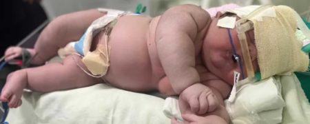 نوزادی ۷ کیلوگرمی با ۶۰ سانتیمتر قد از طریق سزارین در برزیل به دنیا آمد