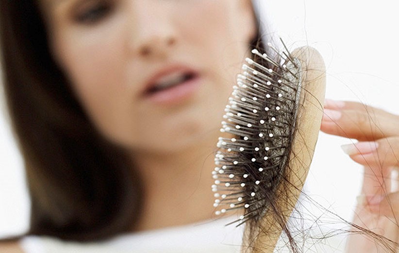 برای جلوگیری از ریزش مو موثرترین راه های پیشگیری چیست؟