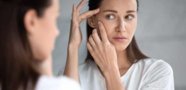 با روش های خانگی از بین بردن جای زخم آشنا شوید