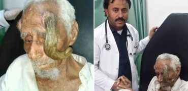 درگذشت پیرترین مرد جهان با ۱۴۰ سال سن که دو شاخ روی سرش داشت