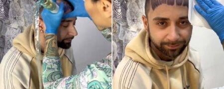 رویای جوان ایتالیایی برای پوشاندن طاسی سرش با تتو به کابوس تبدیل شد + ویدیو