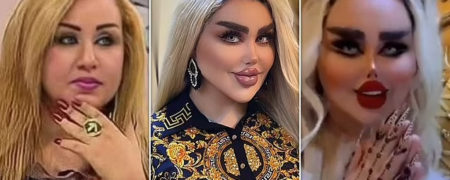 باربی عراقی؛ زنی که بیش از ۵۰ عمل زیبایی انجام داده تا شبیه عروسک باربی شود