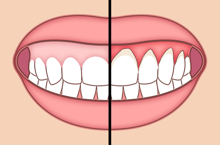 ۶ عادت مثبت که دندان‌هایتان قدردان‌شان خواهند بود