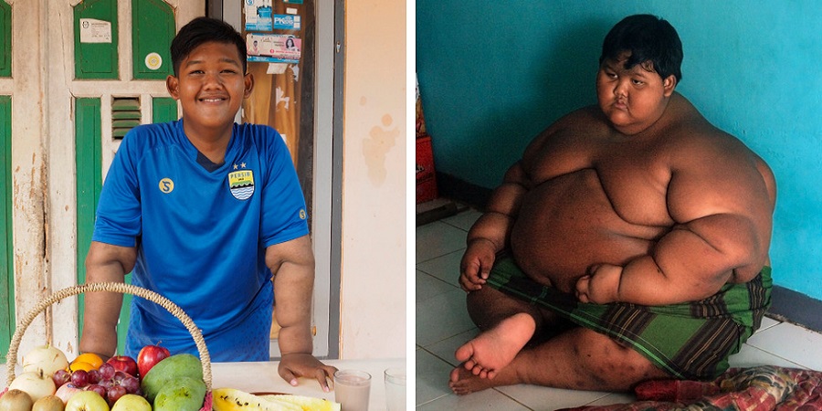 آریا پرمانا چاق ترین کودک دنیا که با کاهش وزن خود شگفتی ساز شد