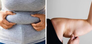 نوع چربی بدن تان درباره سلامت تان چه می گوید؟