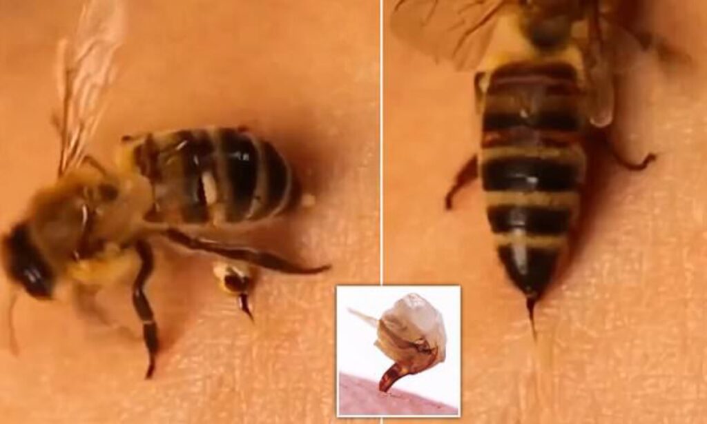 وقتی زنبور شما را نیش می زند دقیقا چه اتفاقی می افتد؟ + ویدیو