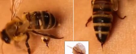 وقتی زنبور شما را نیش می زند دقیقا چه اتفاقی می افتد؟ + ویدیو