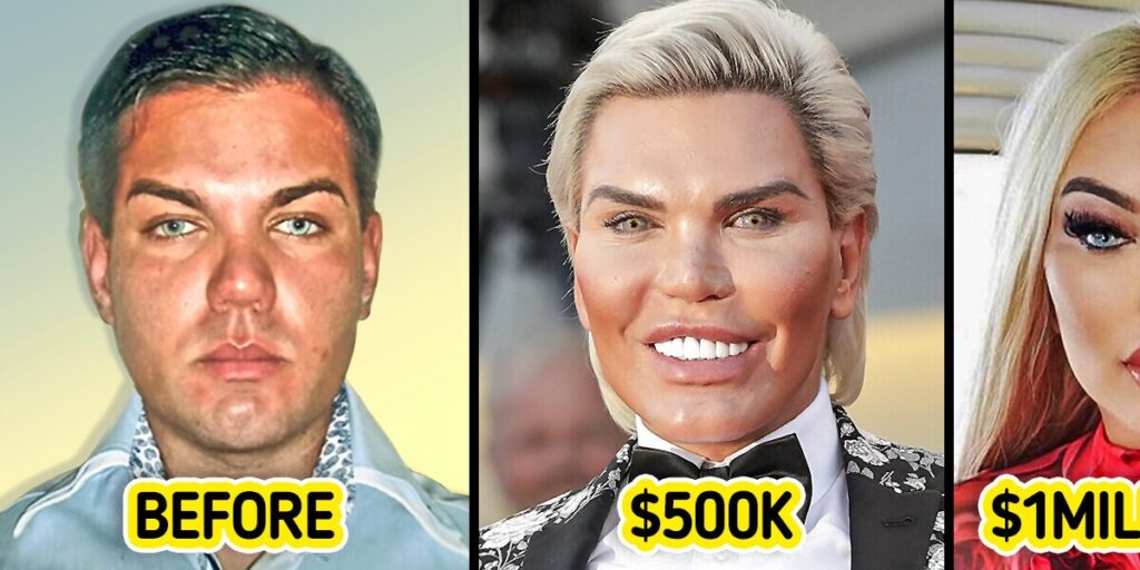این مرد برزیلی یک میلیون دلار خرج کرد تا شبیه عروسک باربی شود