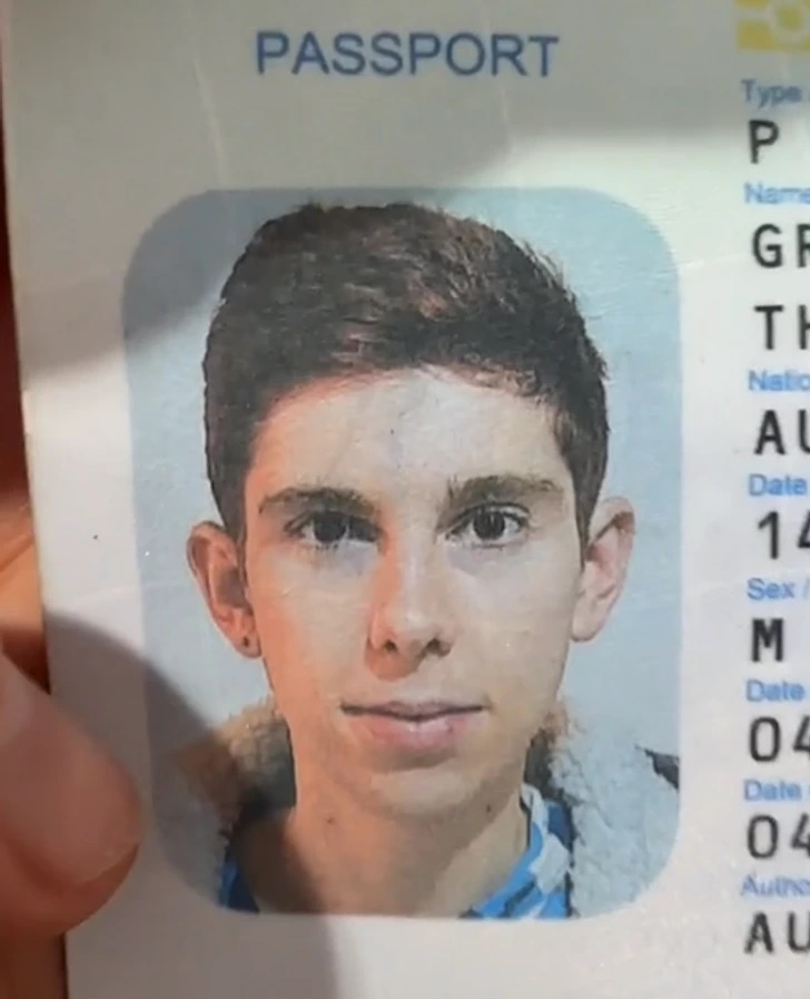 تفاوت ظاهری شدید مرد ۳۰ ساله با عکس پاسپورتش به خاطر جراحی پلاستیک