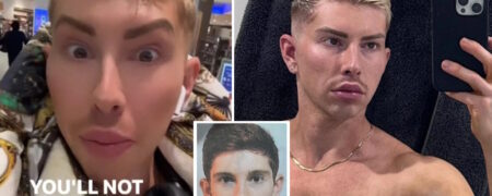 ماجرای مردی که به خاطر جراحی پلاستیک شدید در فرودگاه قابل شناسایی نبود