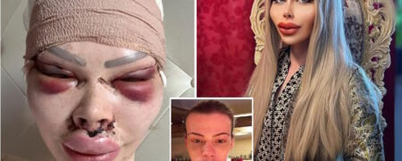 مردی که ۶۰,۰۰۰ پوند خرج کرده تا ظاهری عروسکی و پلاستیکی داشته باشد