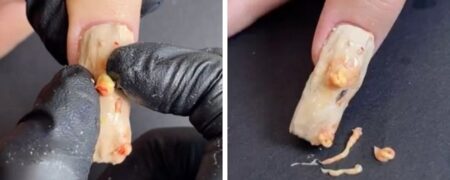 طراحی ناخن چندش آوری که به شکل جوش های چرکی قابل ترکاندن است! + ویدئو