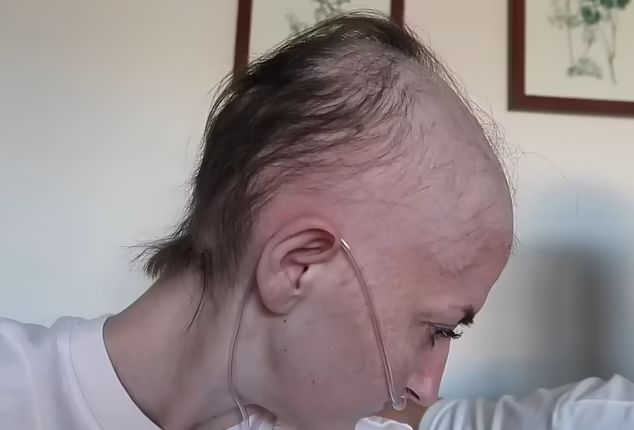 یوتیوبری مبتلا به سرطان از کودکانش برای تراشیدن سرش کمک گرفت + ویدیو