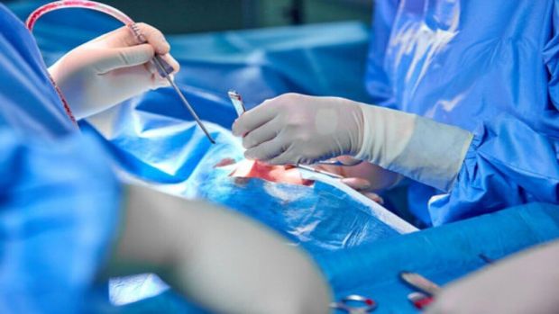عمل جراحی موفقیت آمیز پیوند سر قطع شده برای اولین بار در ایران