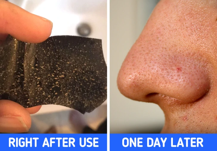 6 نکته که باید قبل از استفاده از چسب پاک کننده بینی بدانید