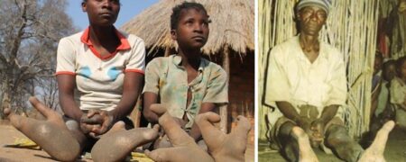 قبیله آفریقایی با پاهای شترمرغی: چرا مردم «وادوما» فقط دو انگشت پا دارند؟