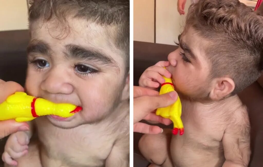 نوزاد پُرموی برزیلی کاربران شبکه های اجتماعی را شوکه کرد + ویدیو