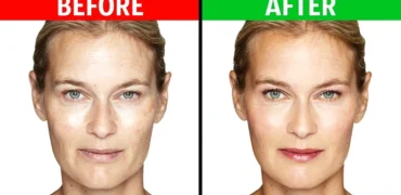 ۷ تمرین موثر برای از بین بردن چین و چروک های صورت در ۱۲ دقیقه