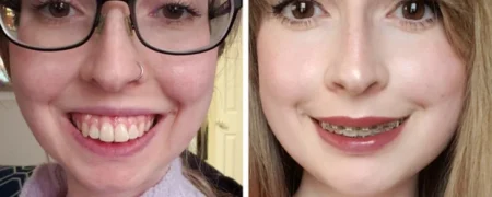 نتیجه ۲۰ جراحی زیبایی که این زنان را به آرزویشان رساند