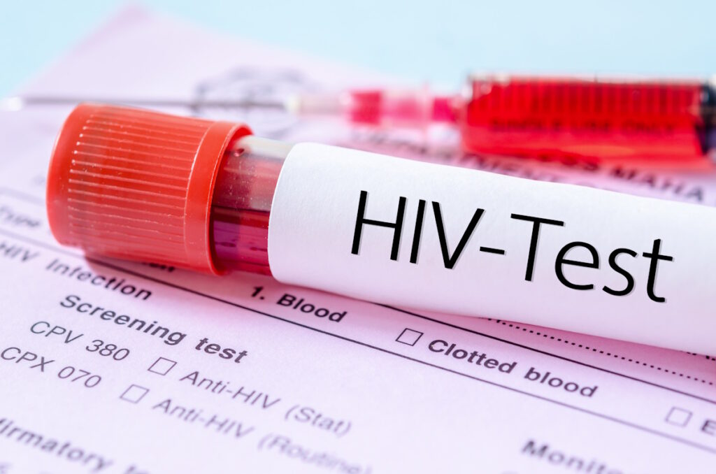 شناسایی دارویی جدید برای درمان ایدز