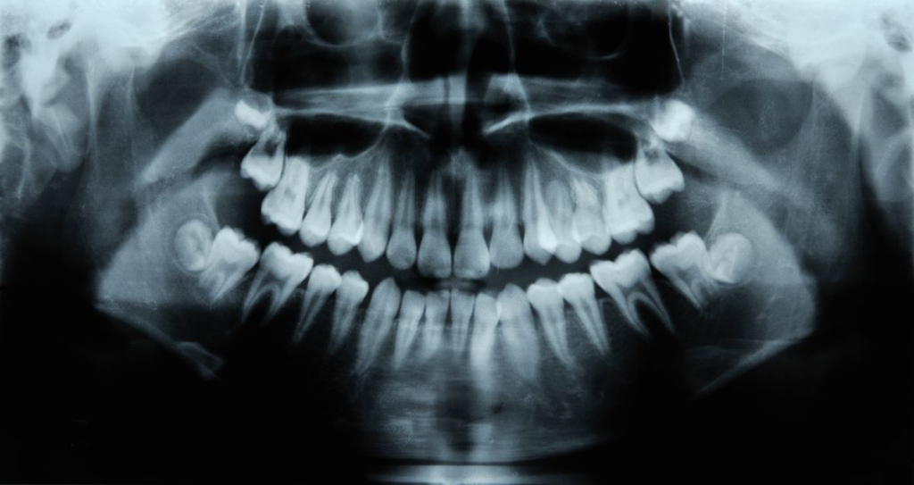 امکان رویش دندان های تازه در انسان ها با ابداع دارویی جدید تا سال ۲۰۳۰