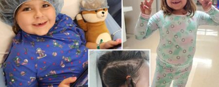 عمل جراحی ۱۰ ساعته برای خاموش کردن نیمی از مغز دختر ۶ ساله برای درمان بیماری نادر