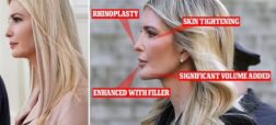 تغییرات ظاهری ایوانکا ترامپ و فهرست طولانی مورد ادعای جراحان از عمل های زیبایی او