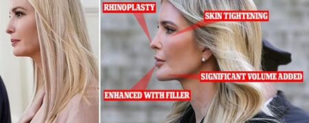 تغییرات ظاهری ایوانکا ترامپ و فهرست طولانی مورد ادعای جراحان از عمل های زیبایی او