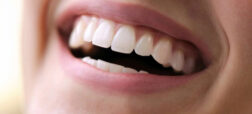 آیا برای مراقبت از دندان‌های روکش‌شده به خمیر دندان خاصی نیاز داریم؟