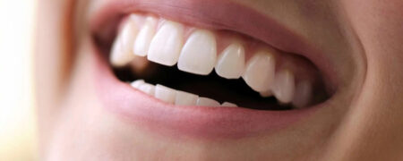 آیا برای مراقبت از دندان‌های روکش‌شده به خمیر دندان خاصی نیاز داریم؟