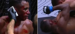 ترکیدن گوش مبارز MMA در اثر ضربه مشت حریف که به مبارزه پایان داد + ویدیو