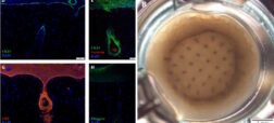 گامی بزرگ در جهت درمان طاسی با چاپ سه بعدی فولیکول های مو برای اولین بار + ویدئو