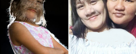 ازدواج دختر گرگ نما؛ تصاویر پرموترین دختر جهان پس از تراشیدن موهای صورتش