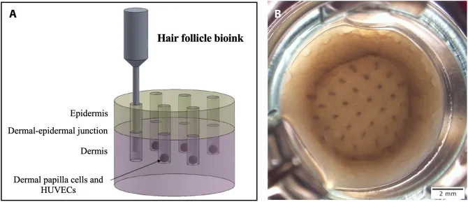 چاپ سه بعدی فولیکول های مو برای اولین بار و افزایش امید به درمان طاسی + ویدئو