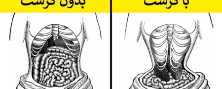 ۹ حقیقت باورنکردنی درباره مُدهای عجیب و غریب دوران ملکه ویکتوریا