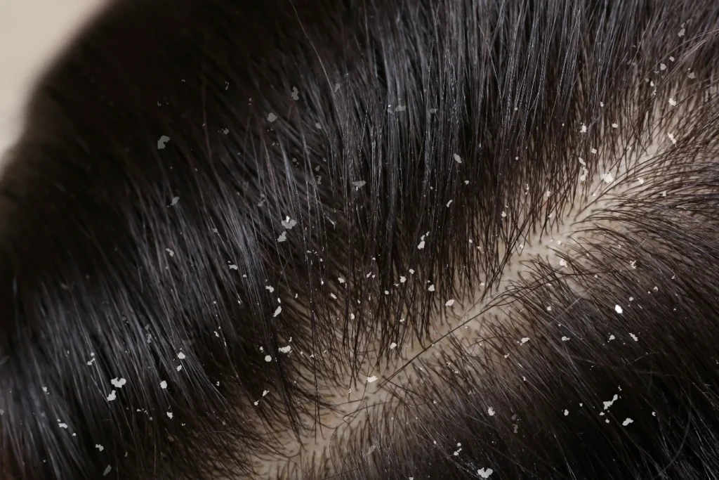 واقعیاتی در مورد موی بدن که شاید حالتان را بد کنند