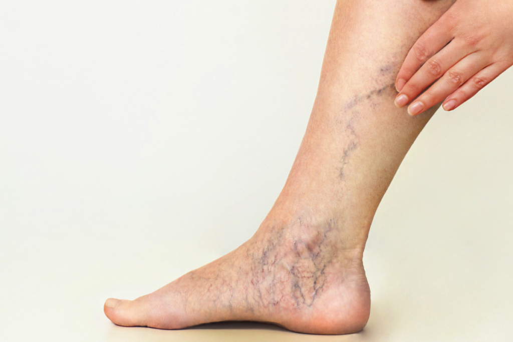 ۵ علامت مشکلات کبدی که در پاهایتان ظاهر می‌شود