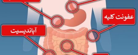درد هر قسمت از شکم نشان دهنده چه مشکلی است؟