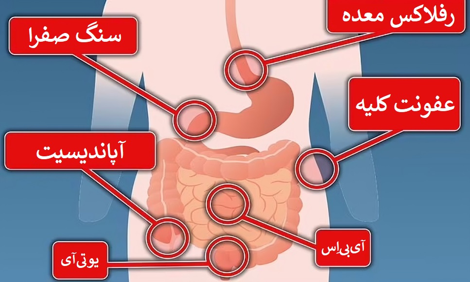 درد هر قسمت از شکم نشان دهنده چه مشکلی است؟