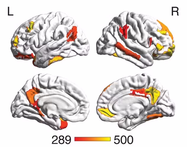 شناسایی قسمت های متفاوت مغز زنان و مردان توسط هوش مصنوعی 