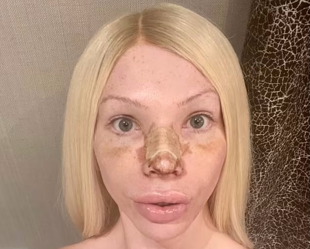 زنی که ۵۰,۰۰۰ دلار خرج جراحی پلاستیک کرده به دنبال ظاهر طبیعی خود است