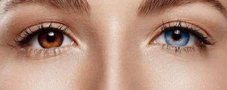 چه زمانی عمل تغییر رنگ چشم جنبه درمانی  دارد؟