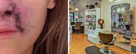بازار گرم جراحی‌های زیبایی در آرایشگاه‌ها و نتایج فاجعه بار آن + ویدیو