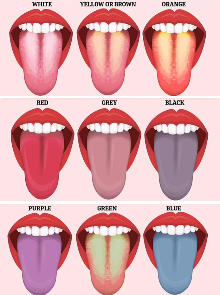 رنگ زبان چه چیزی در مورد سلامت شما می‌گوید؟